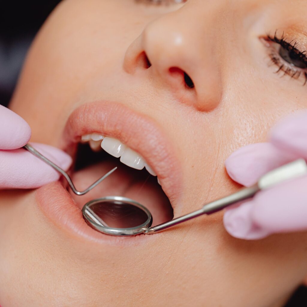 Porcelain Veneers require more tooth reduction to make space available for porcelain. Porcelain needs bulk to have sufficient strength. Porcelain is also used for crowns and fixed partial prostheses. 