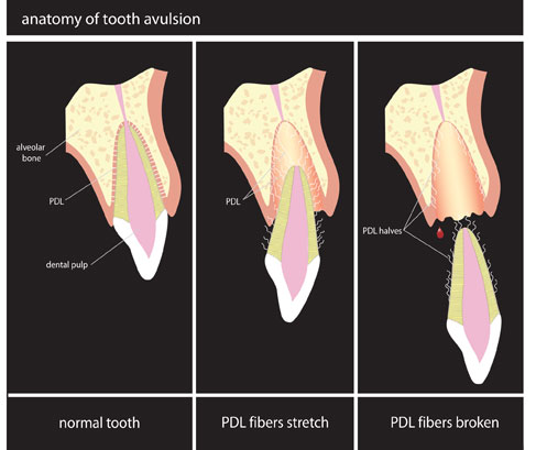 In that way, you can maintain the viability of the periodontal ligament fibers and the cells surrounding the root of your teeth, which would eventually act as a bridge when your dentist puts it back in the socket. 