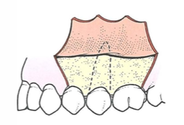 Image from Contemporary Oral and Maxillofacial Surgery, 5e-Mosby (2008)