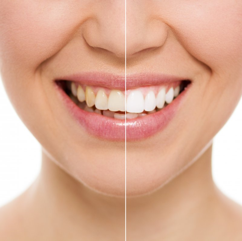 How Can I Whiten My Teeth: 10 Natural Ways To Whiten Your Teeth