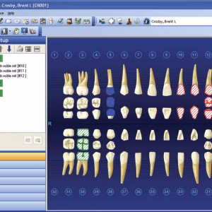 Dentrix Charting: Basic Knowledge In Using Dentrix
